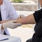 Se realizarán controles gratuitos para la detección de psoriasis
